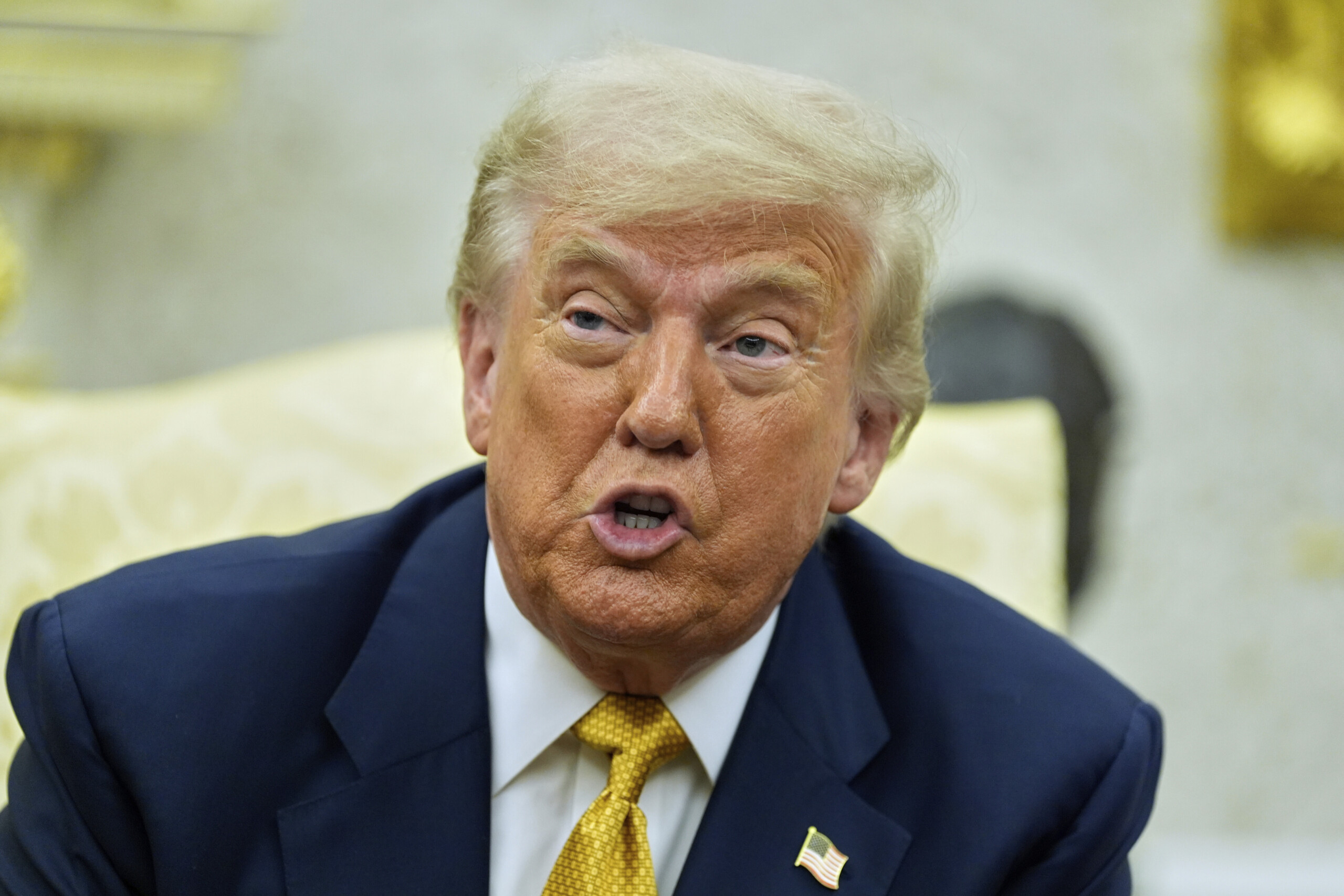 usa white house trump has chronic venous insufficiency scaled
