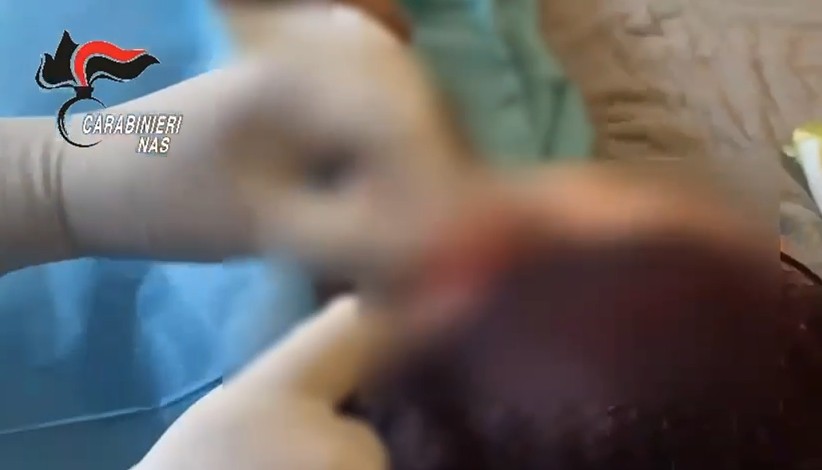 rome doctor suspended from practice caught performing plastic surgery