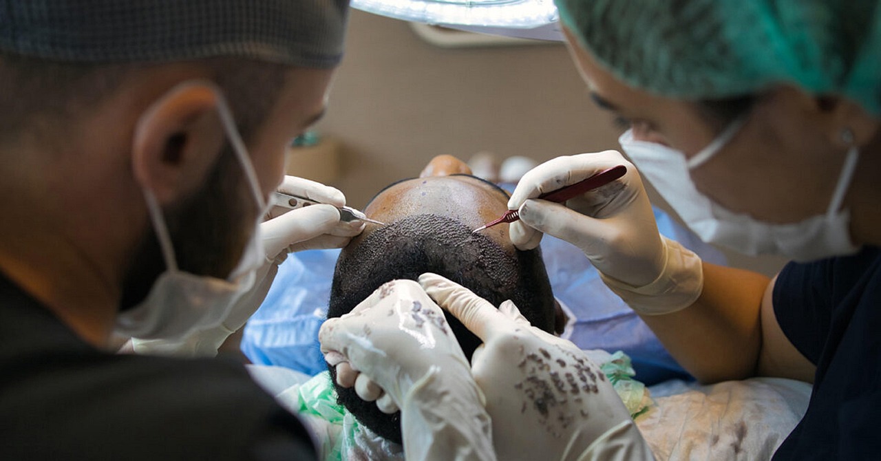 turkey feels ill during hair transplant 38 year old british man dies