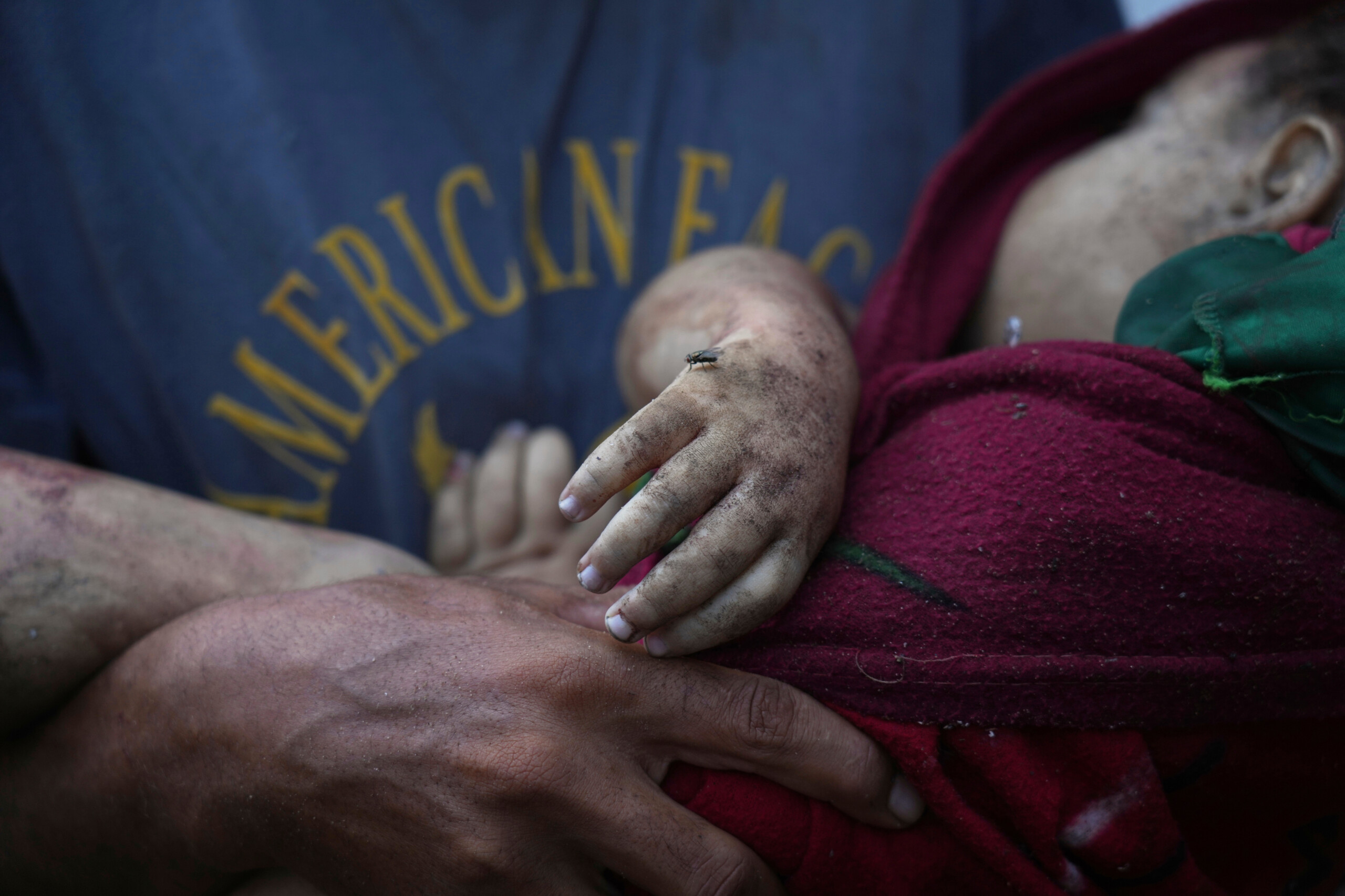 gaza over 300 deaths from starvation since the start of the war 117 children scaled
